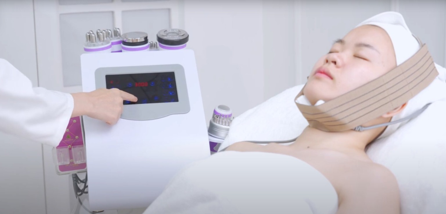 Laser Therapy for Double Chin